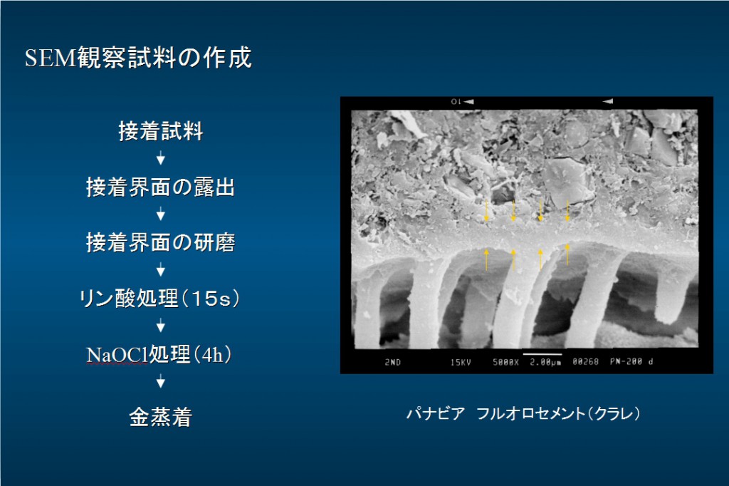 パナビア　ー　象牙質　界面